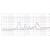 B&C HF148 WaveGuide Flare for ME148 - 100 Degree Horizontal Dispersion - view 4
